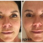 Visage : Massage  facial Kobido